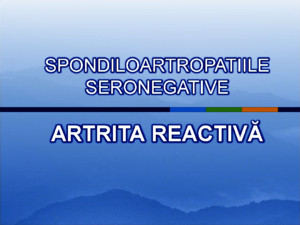 Artrita reactiva PRELEGERE