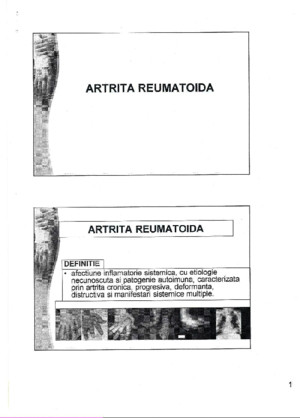 artrita reumatoida
