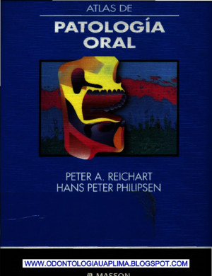 Atlas de Patologia Oral - Peter a Reichart