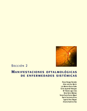 Atlas urgencias en oftalmología