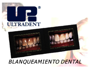 Blanqueamiento Dental Led