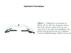 [DES1 Urgences] Traumatisme oculaire / Dr ETuil (17 mars 2012)