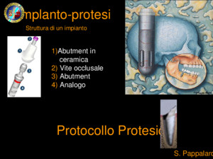 Implanto-protesi Protocollo Protesico 1)Abutment in ceramica 2) Vite occlusale 3) Abutment 4) Analogo Struttura di un impianto S Pappalardo