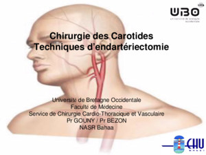 SCIENCES TECHNOLOGIES SANTÉ Chirurgie des Carotides Techniques dendartériectomie Université de Bretagne Occidentale Faculté de Médecine Service de Chirurgie