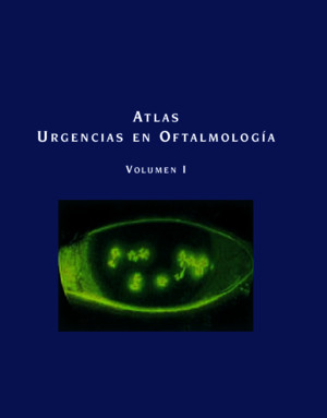 Atlas, Urgencias en Oftalmologia - Alvaro Bengoa Gonzalez, Esperanza Gutierrez Diaz Vol 1