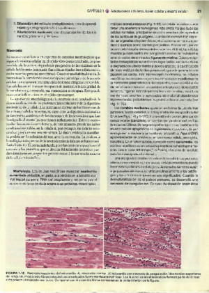 1aNecrosis y Apoptosis de Robbins y Cotran 7a Ed (1)