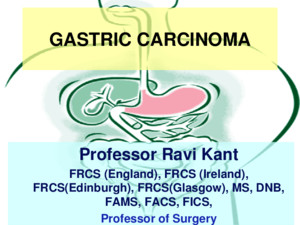 Peptic Ulcer Professor Ravi Kant FRCS (England), FRCS (Ireland), FRCS(Edinburgh), FRCS(Glasgow), MS, DNB, FAMS, FACS, FICS, Professor of Surgery