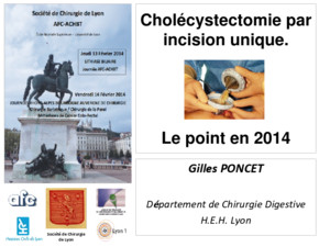Société de Chirurgie de Lyon Cholécystectomie par incision unique Le point en 2014 Gilles PONCET Département de Chirurgie Digestive HEH Lyon